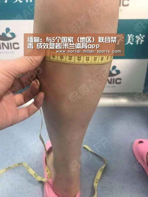缅甸:与5个国家(地区)联合禁毒 成效显著|米兰体育app(图3) 米兰俱乐部